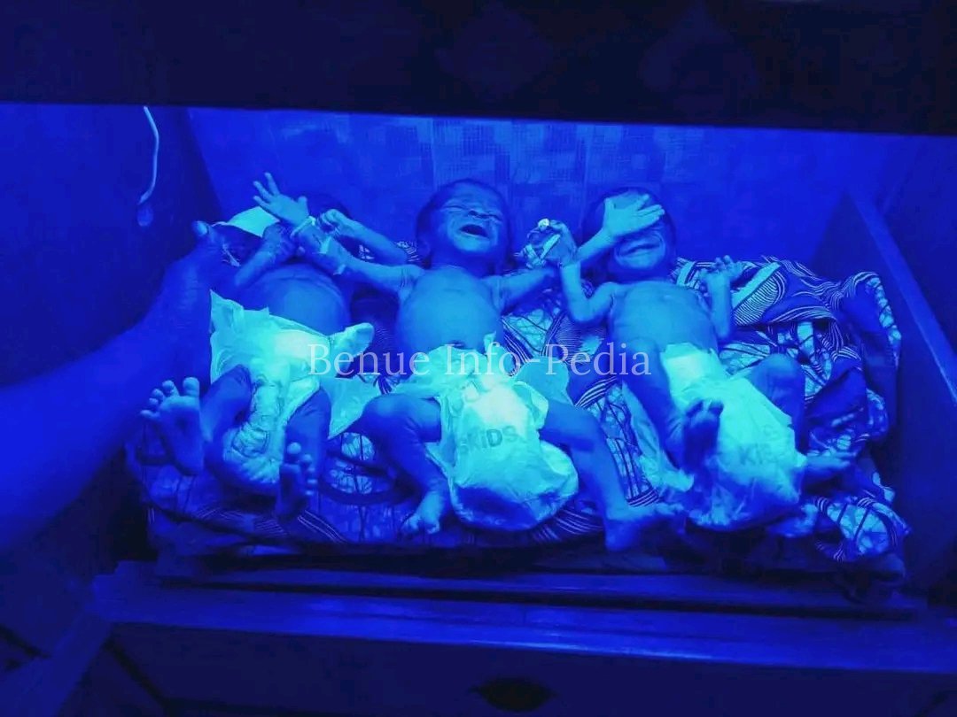 Gboko Mother Dies Following Emergency Delivery of Triplets in Makurdi