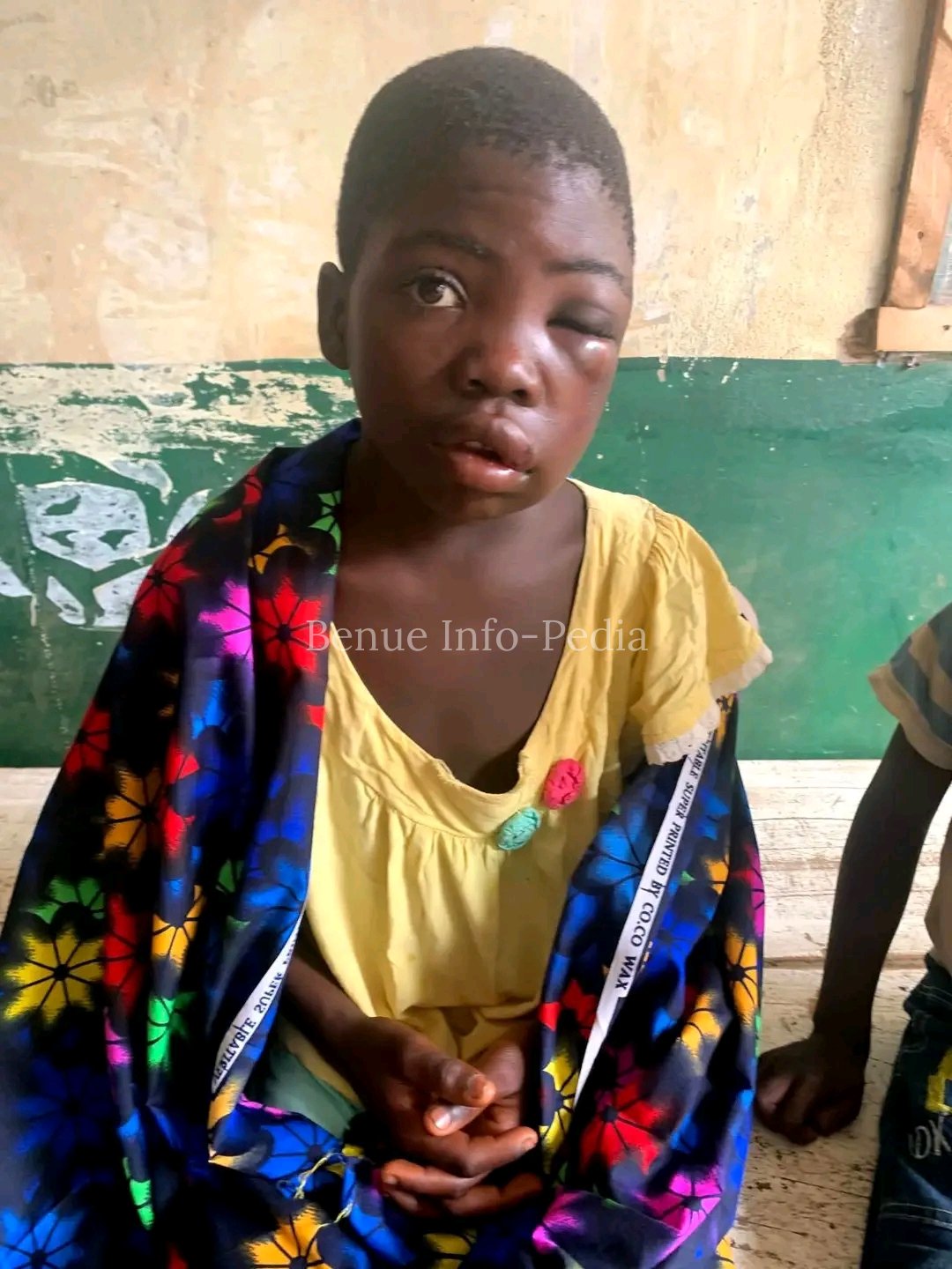 11-Year-Old Orphan Allegedly Beaten and Tied Up Over Missing ₦1,000 in Benue